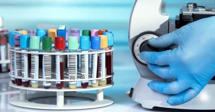 اعلام نتایج کنترل کیفی کود سولفات پتاسیم گرانول جهت رفاه حال کشاورزان عزیر توسط مرکز تحقیقات کاربردی نهاده های کشاورزی 